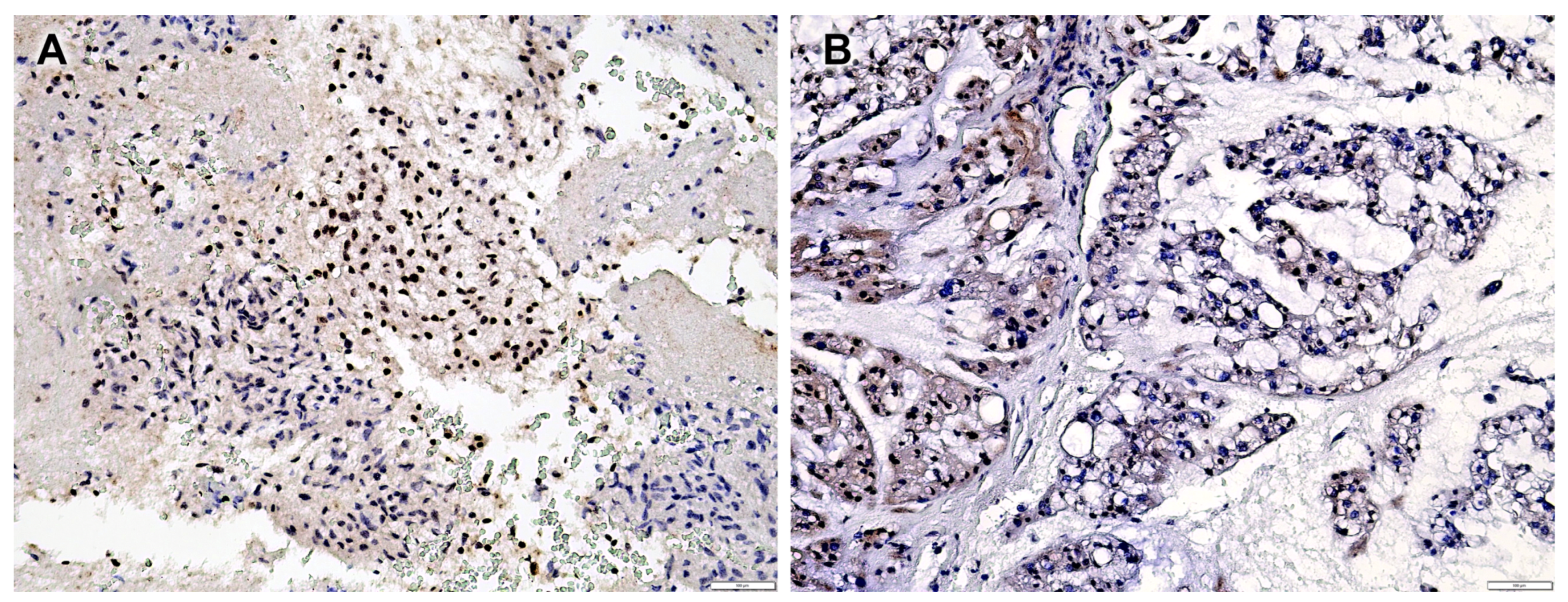 Cancers 16 02808 g001