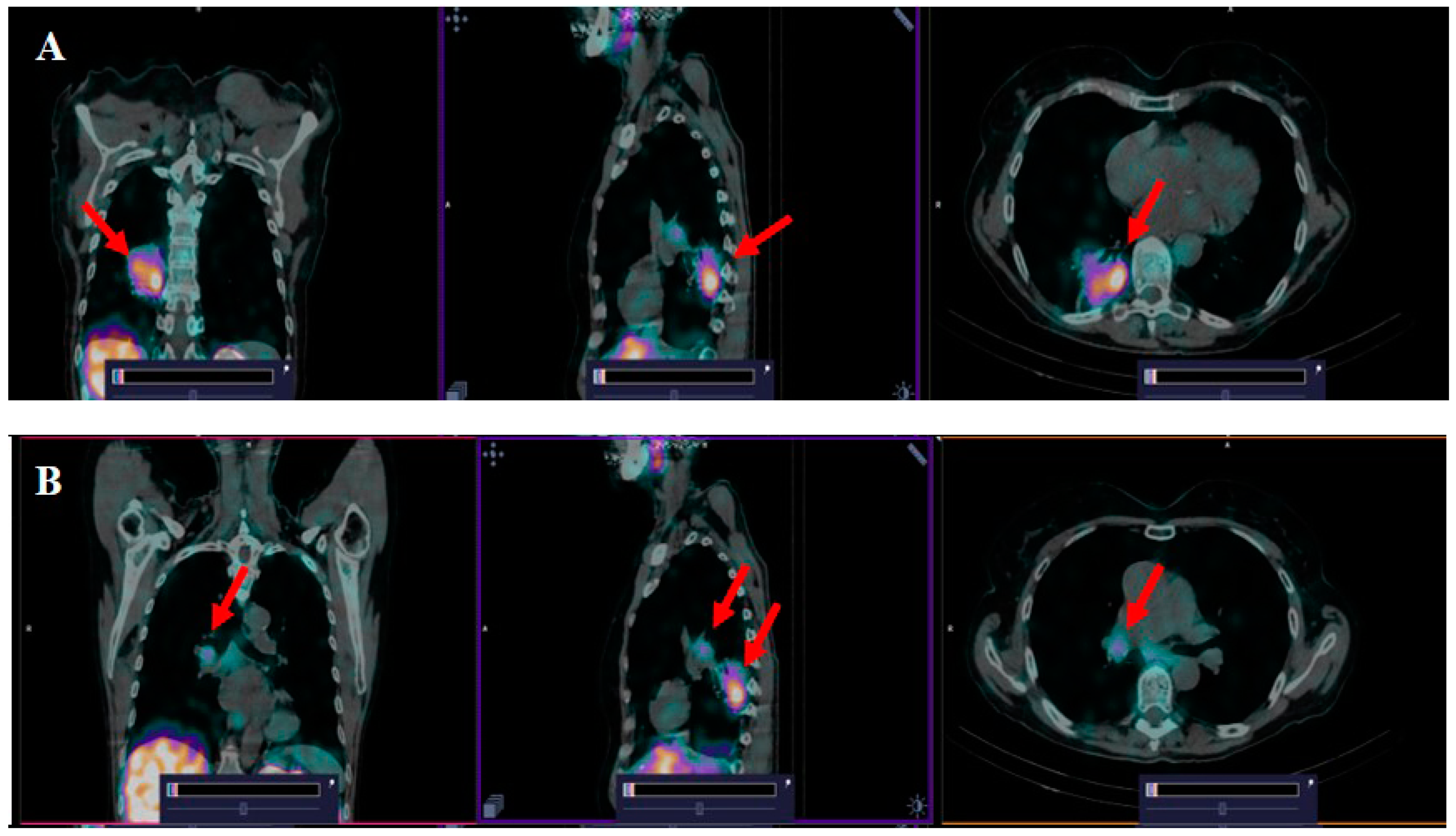 Cancers 16 02815 g003