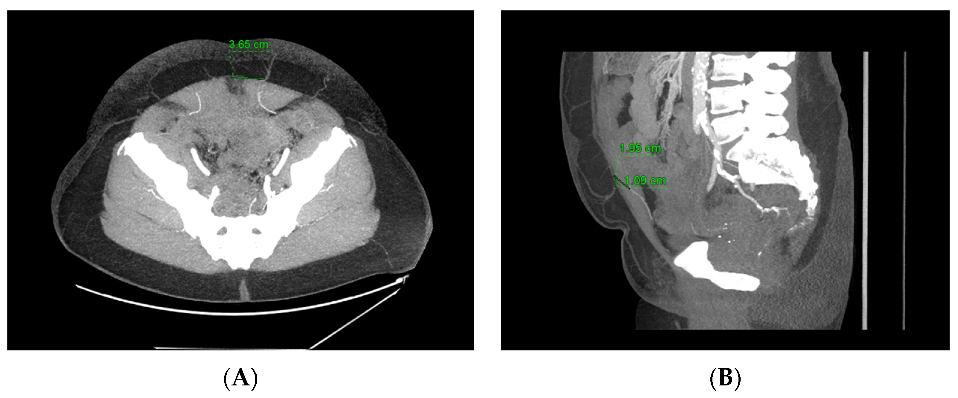 Cancers 16 02851 g001