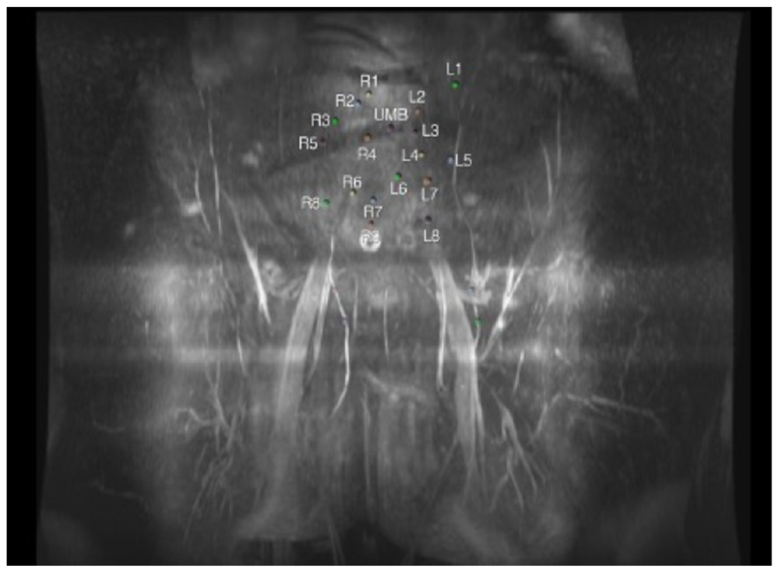 Cancers 16 02851 g002