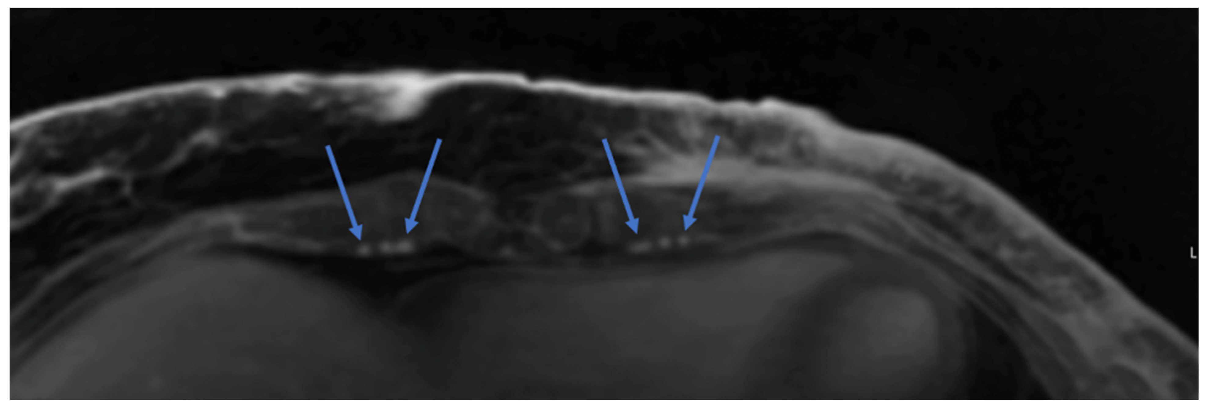 Cancers 16 02851 g003