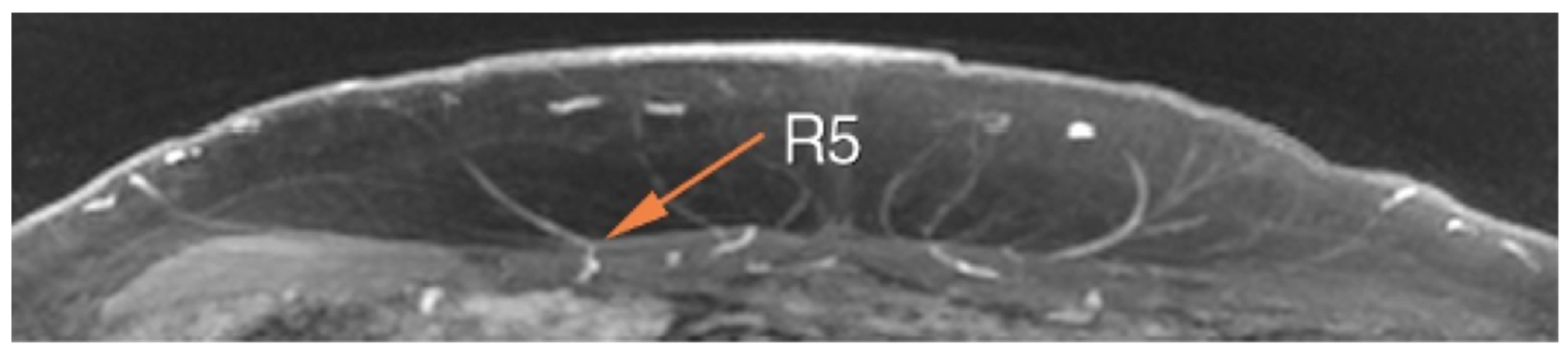 Cancers 16 02851 g004