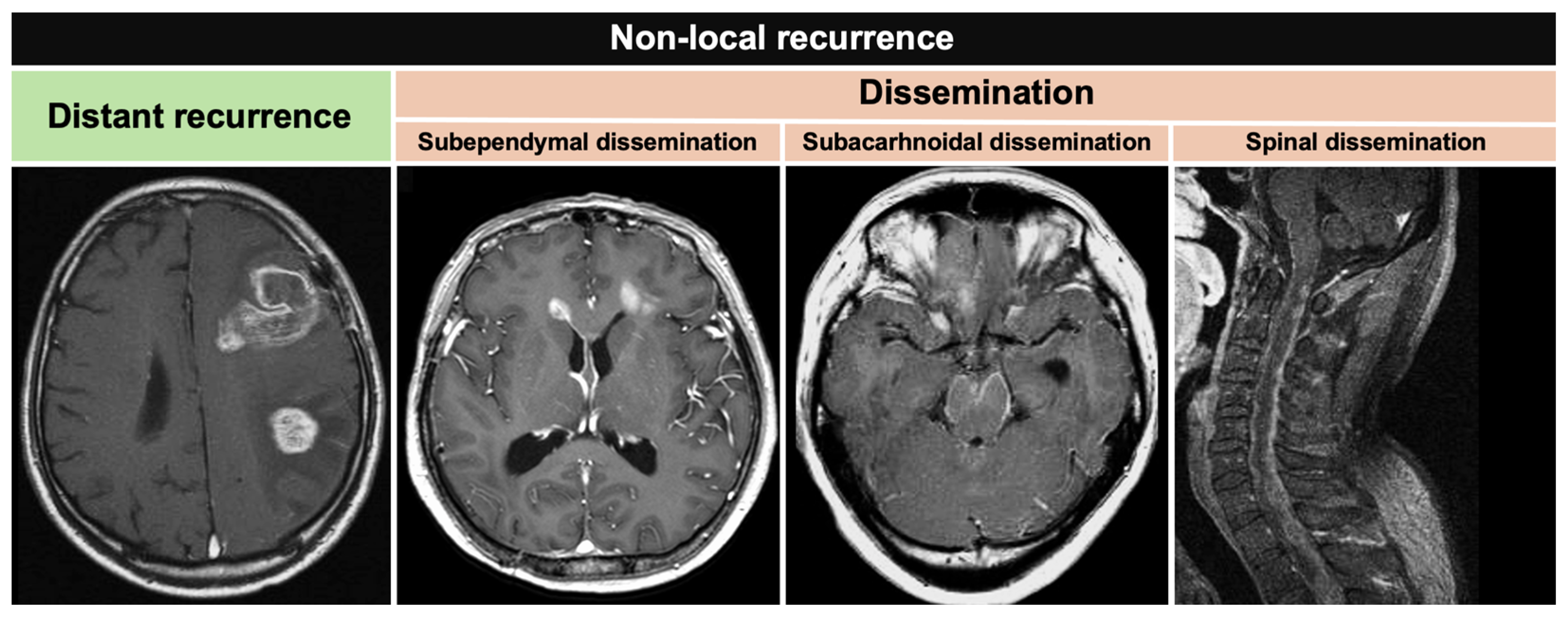 Cancers 16 02873 g001