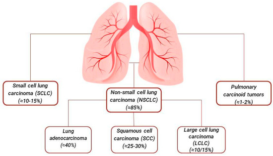 The Genetic Analysis and Clinical Therapy in Lung Cancer: | Dr Qaisar Ahmed MD, DHMS