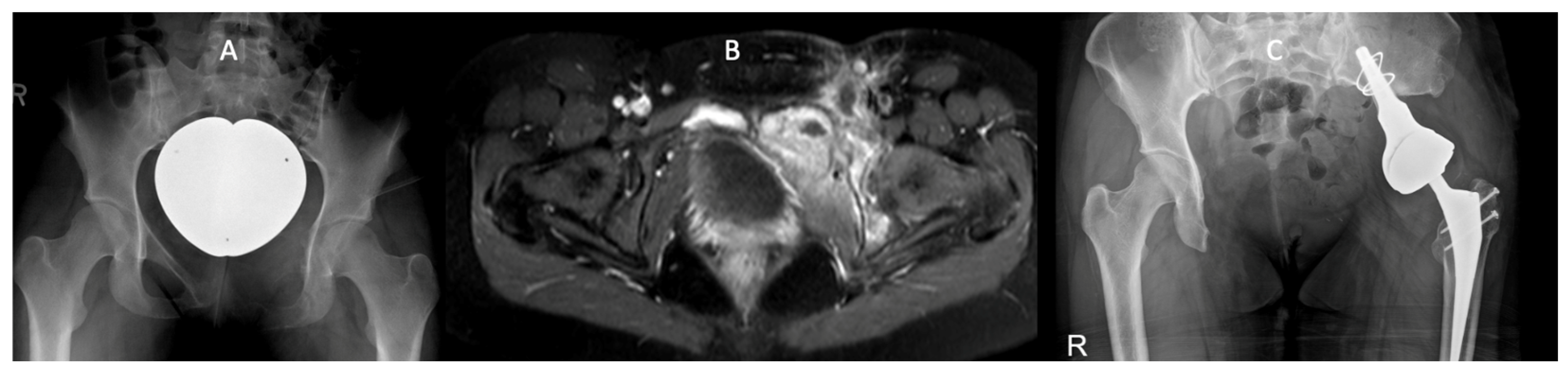 Cancers 16 02890 g003