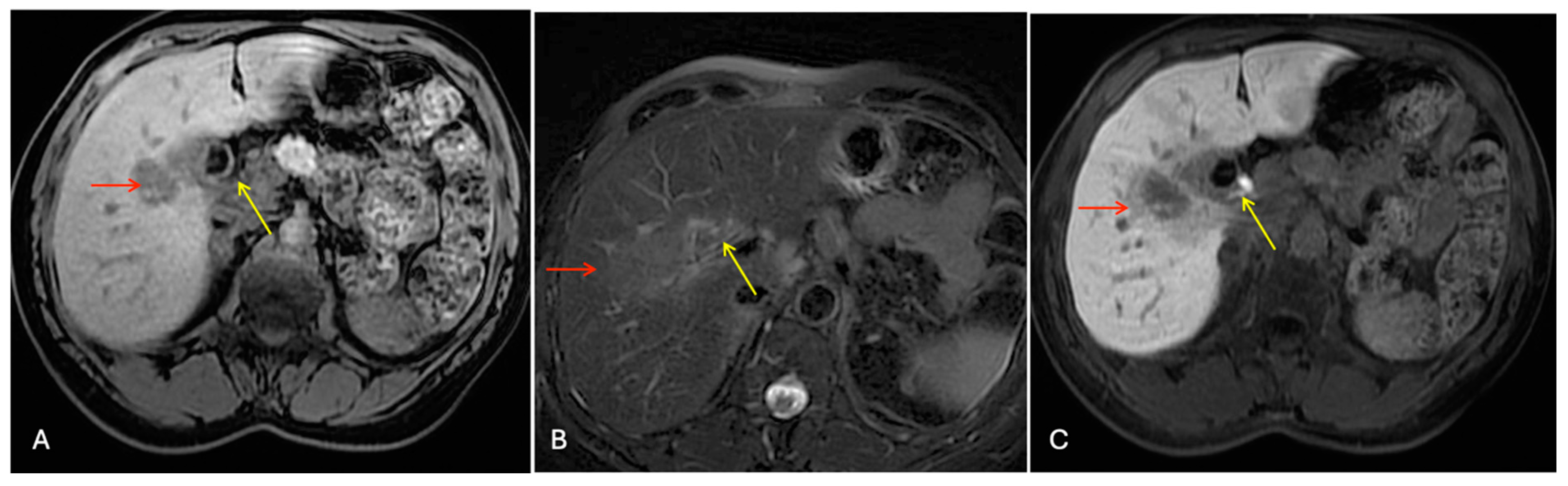 Cancers 16 02926 g002