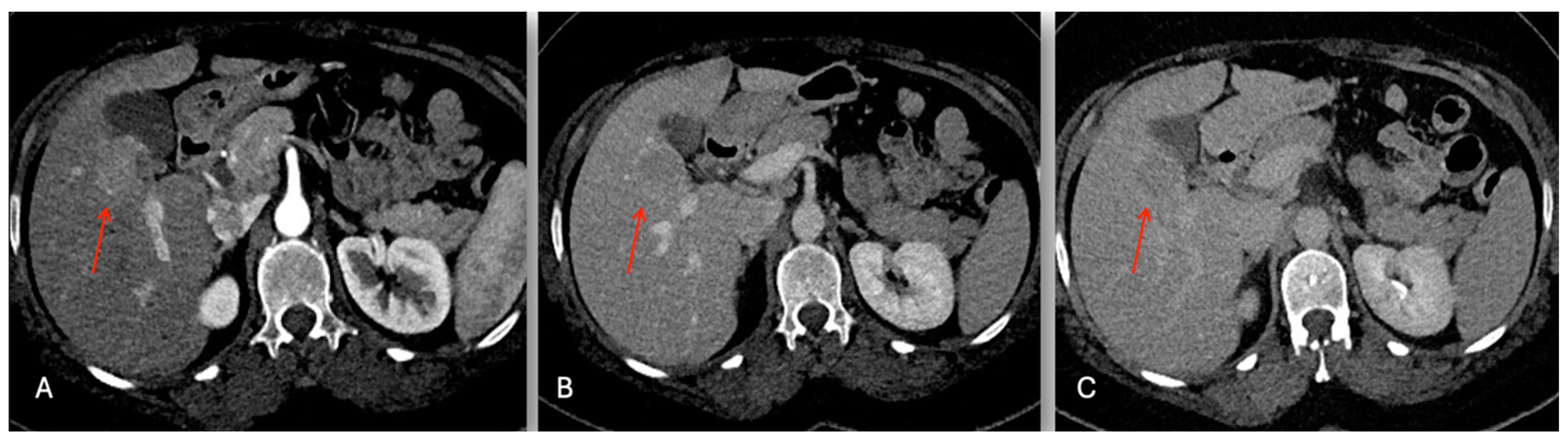 Cancers 16 02926 g005