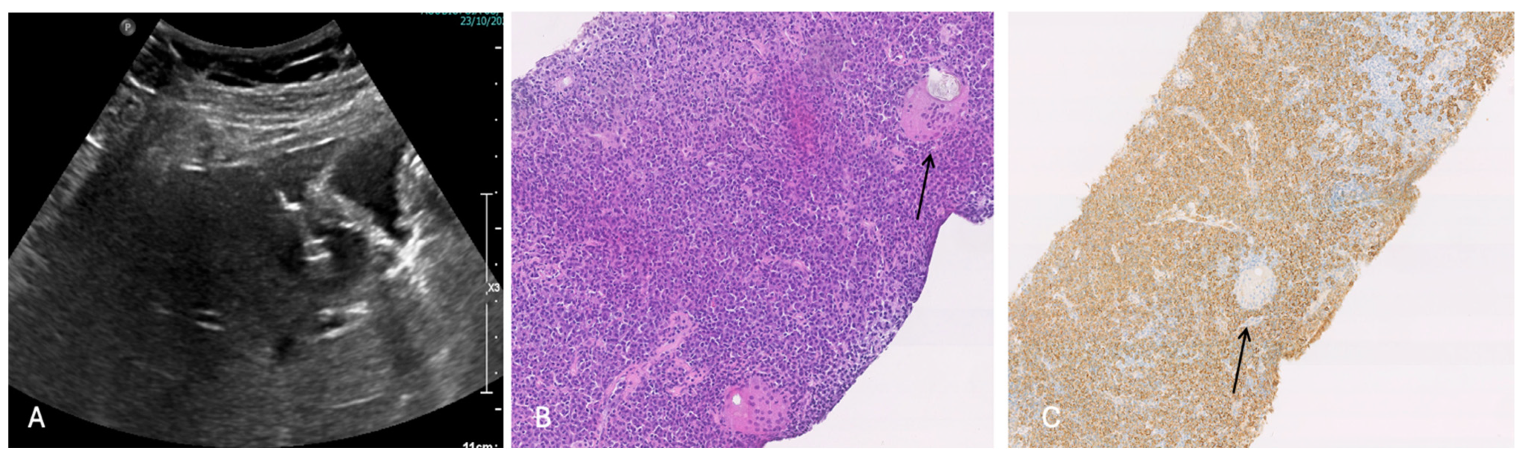 Cancers 16 02926 g006