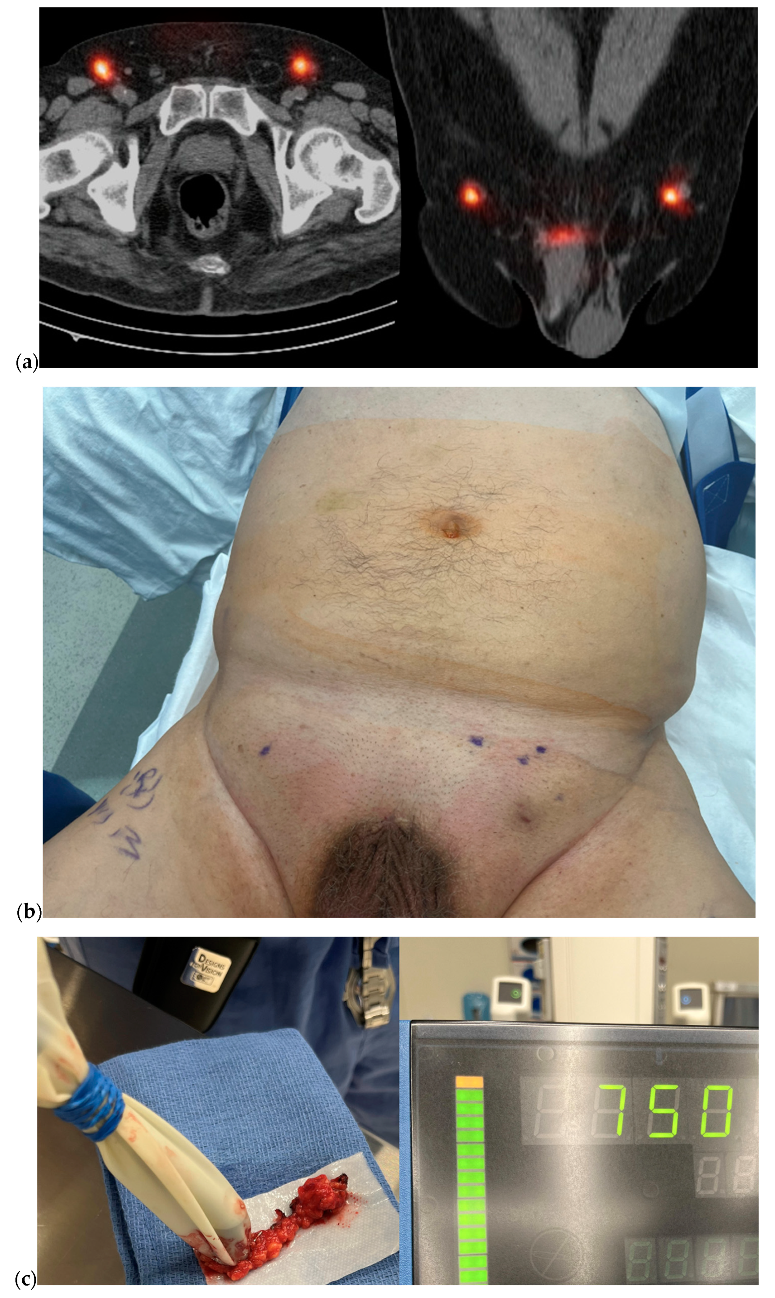 Cancers 16 02935 g002