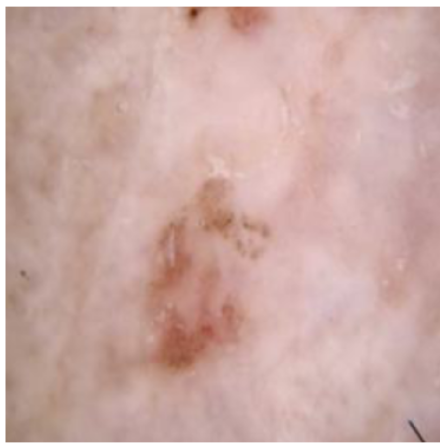 Cancers 16 02947 i001