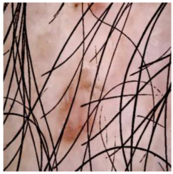 Cancers 16 02947 i008