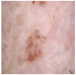 Cancers 16 02947 i009