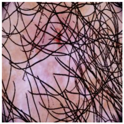 Cancers 16 02947 i011