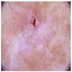 Cancers 16 02947 i012