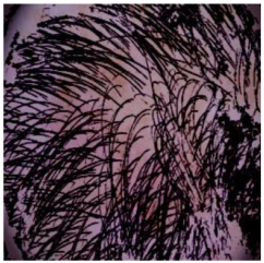 Cancers 16 02947 i014