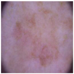 Cancers 16 02947 i015