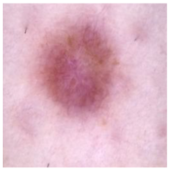 Cancers 16 02947 i016