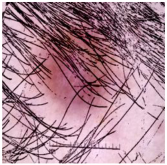 Cancers 16 02947 i017