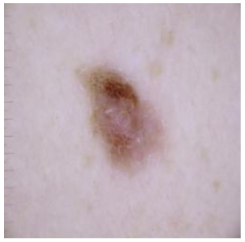 Cancers 16 02947 i019