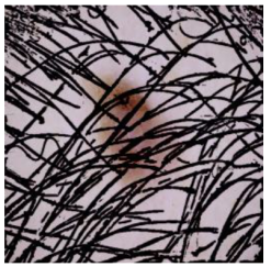 Cancers 16 02947 i020