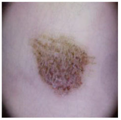 Cancers 16 02947 i024