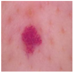 Cancers 16 02947 i025