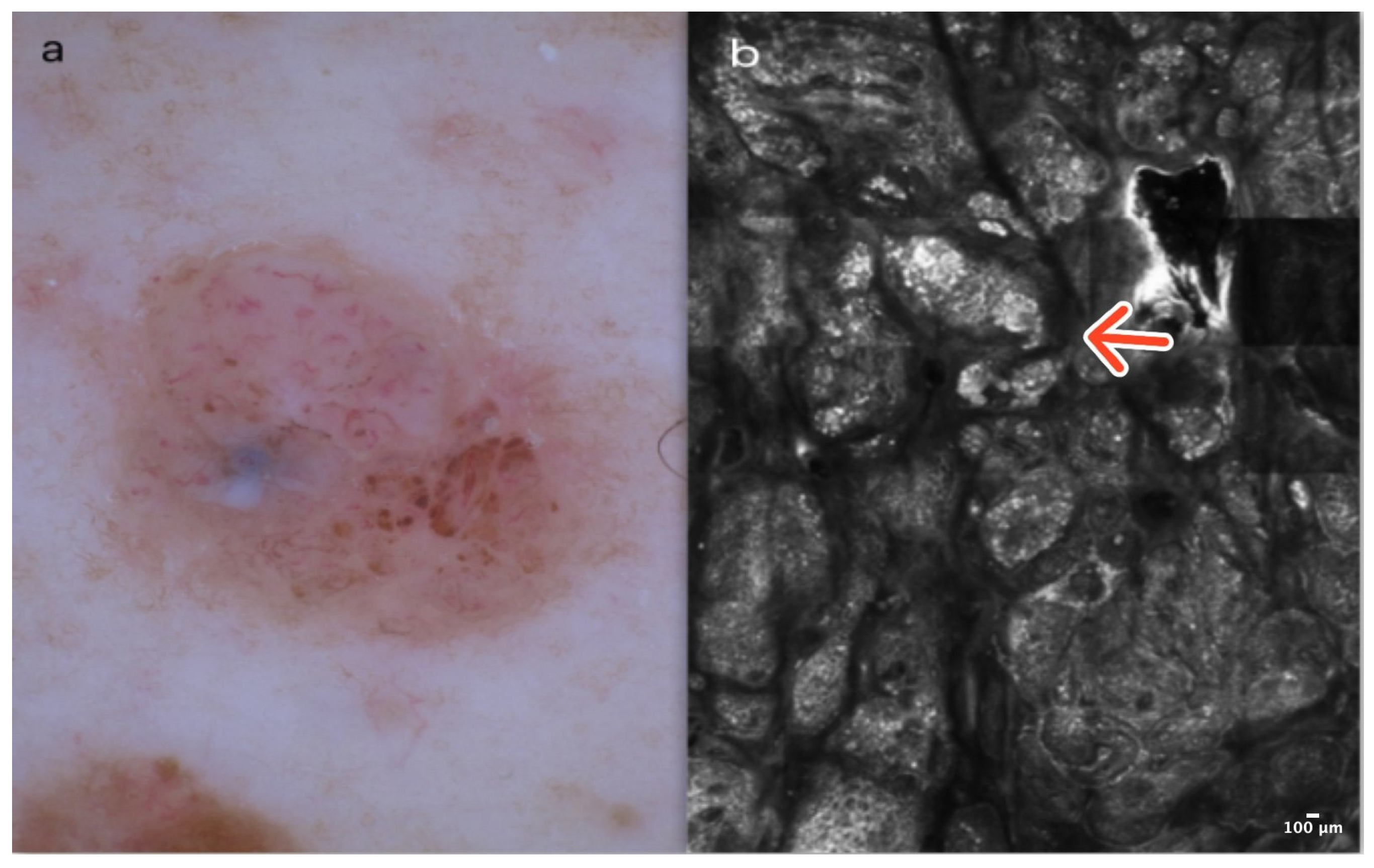 Cancers 16 02972 g003