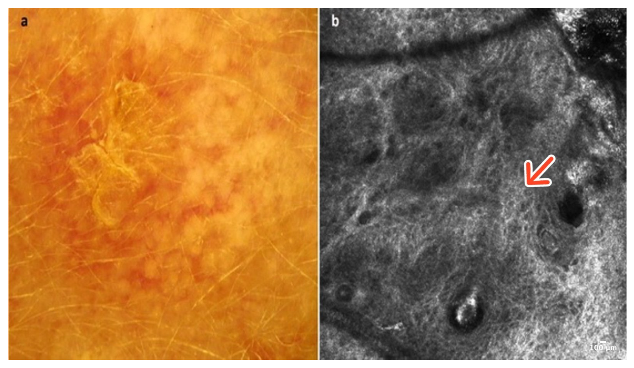 Cancers 16 02972 g008