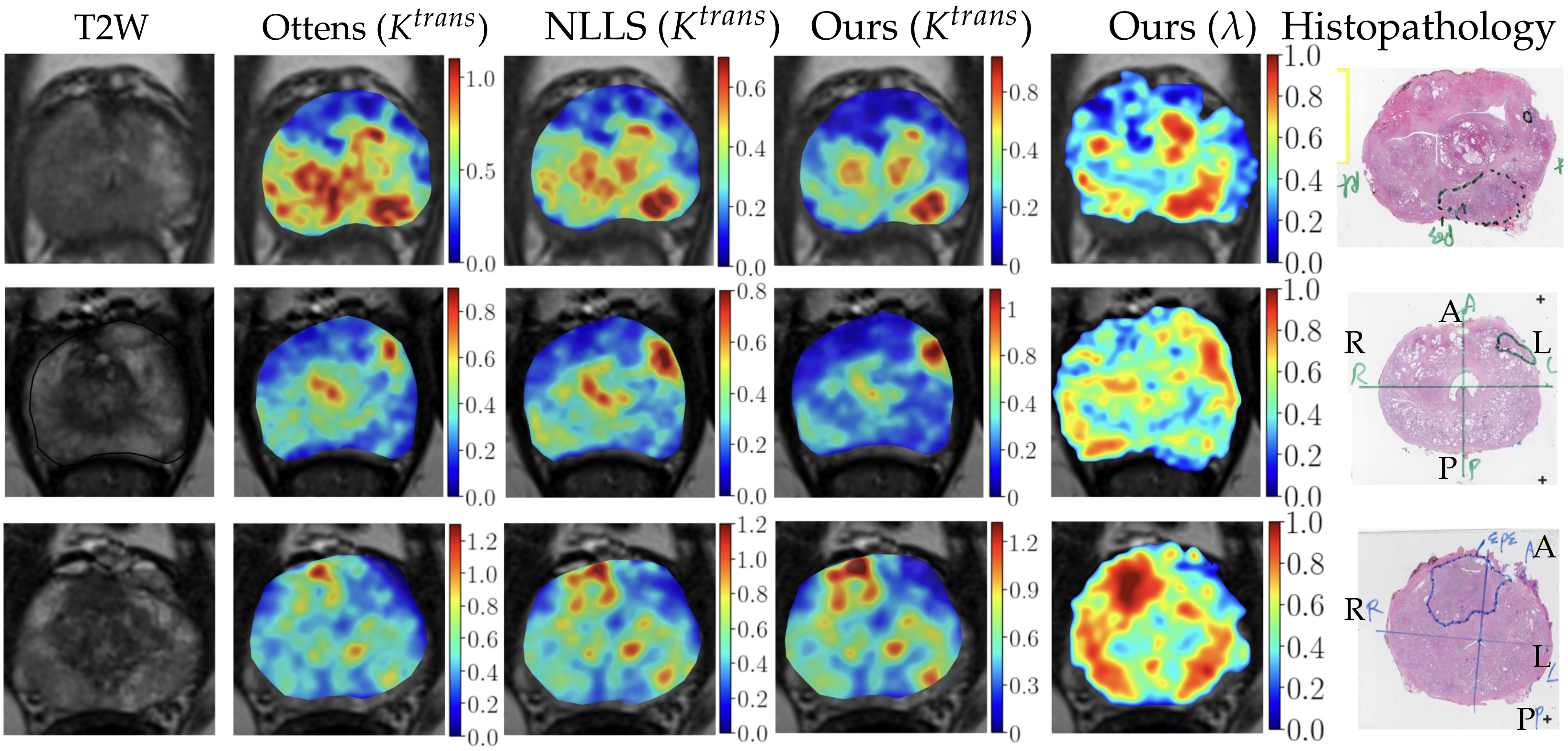 Cancers 16 02983 g011