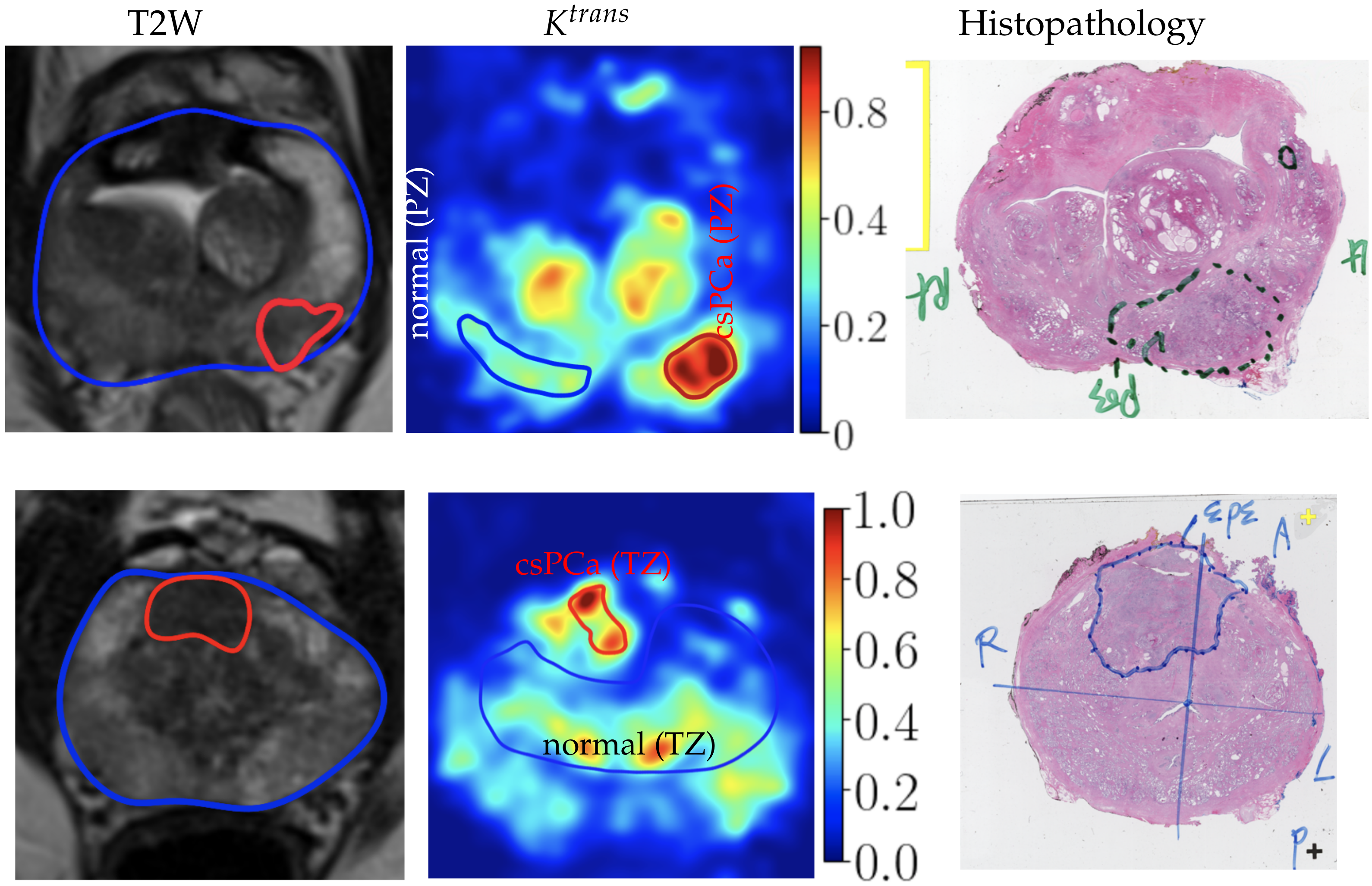Cancers 16 02983 g012