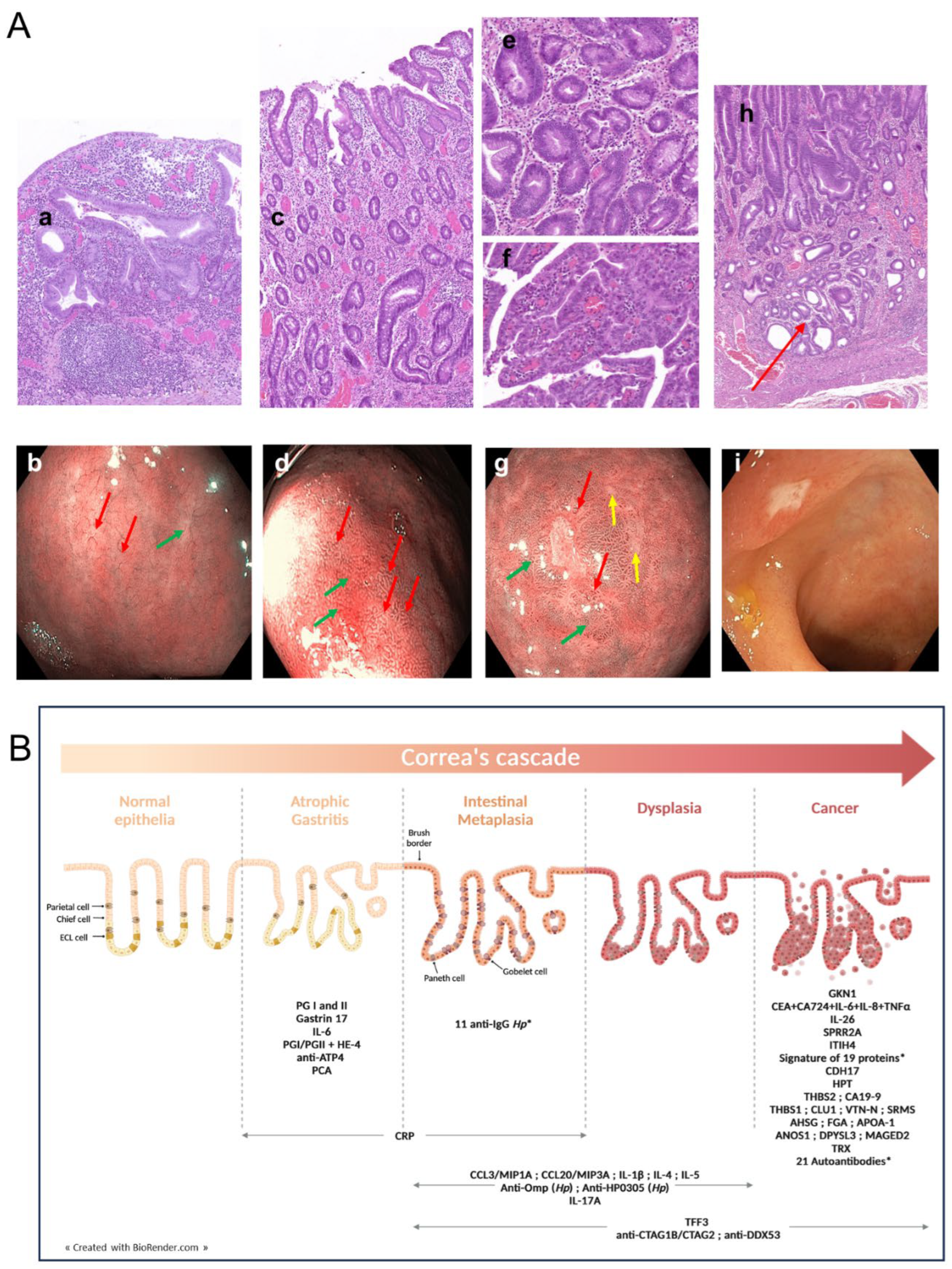 Cancers 16 03019 g001