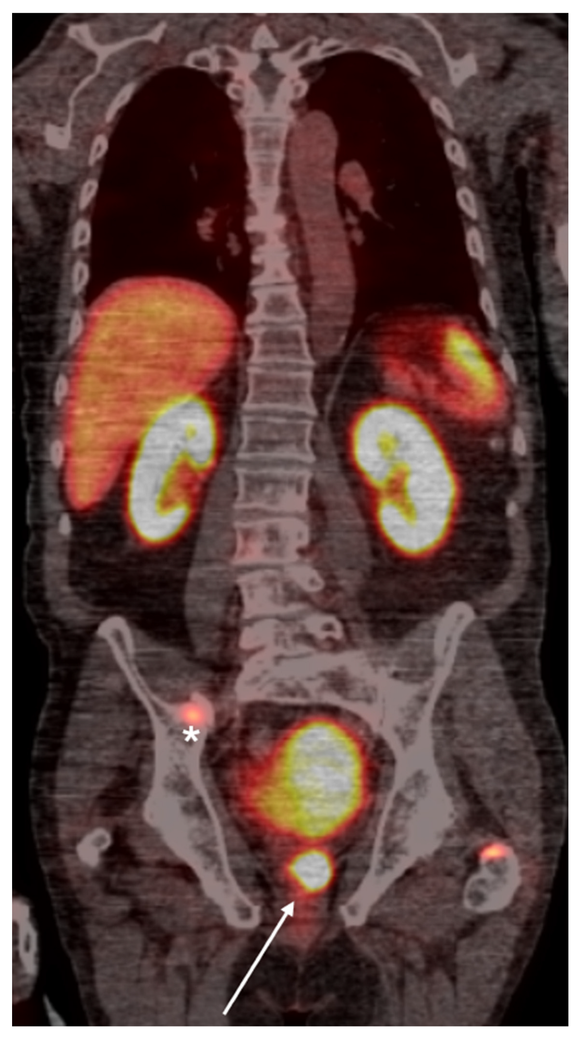 Cancers 16 03039 g002