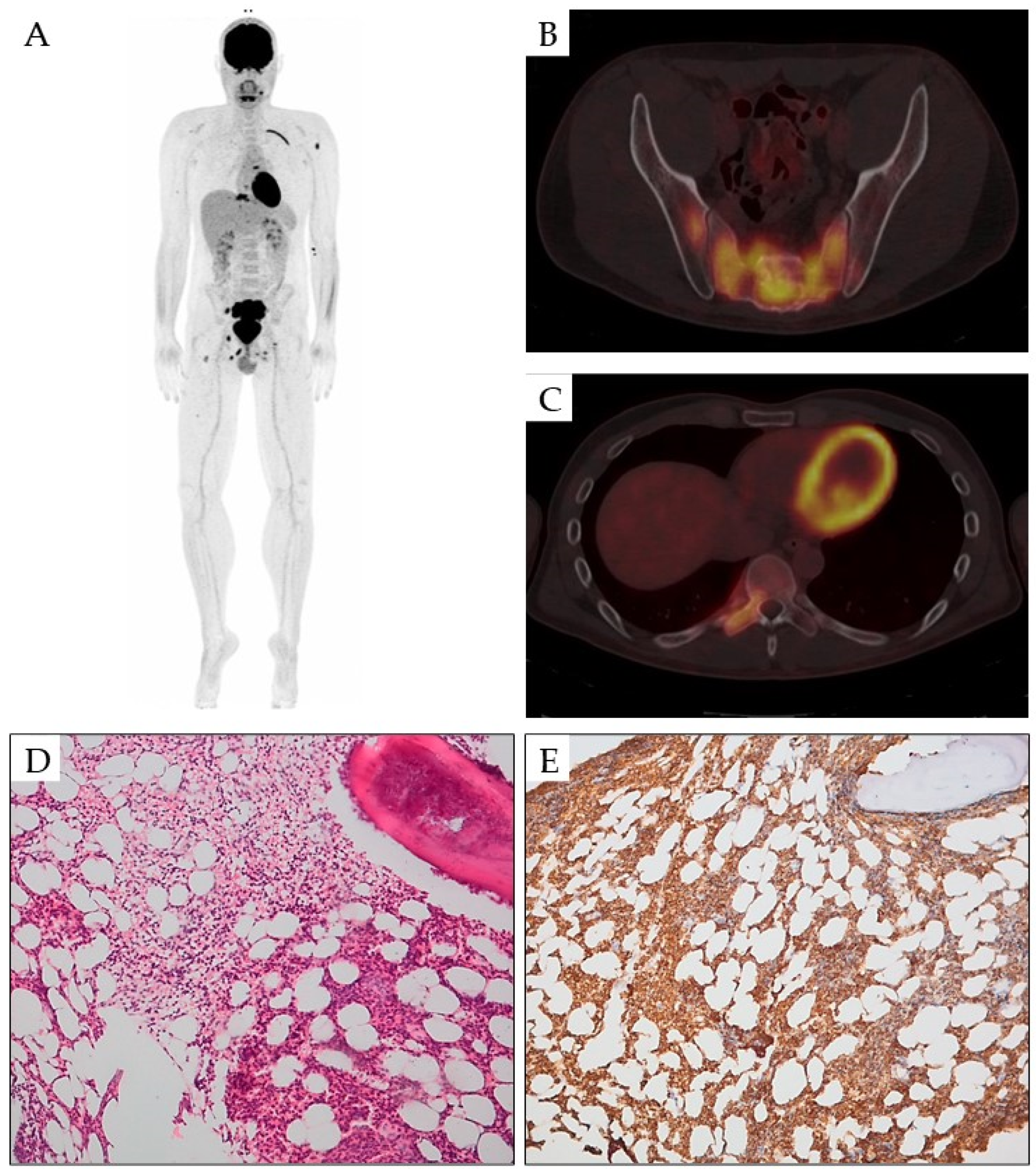 Cancers 16 03054 g001 Cancers 16 03054 g001