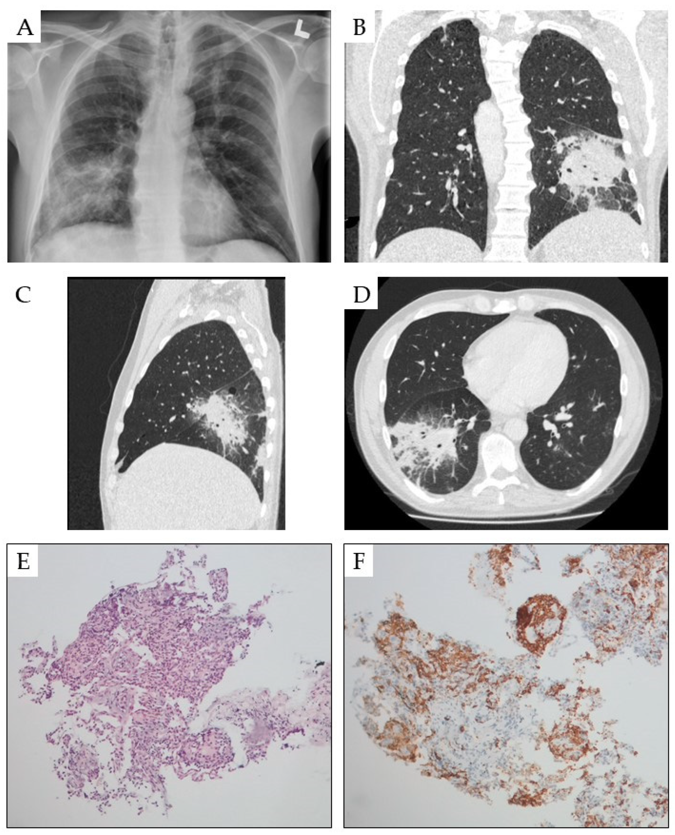 Cancers 16 03054 g002 Cancers 16 03054 g002