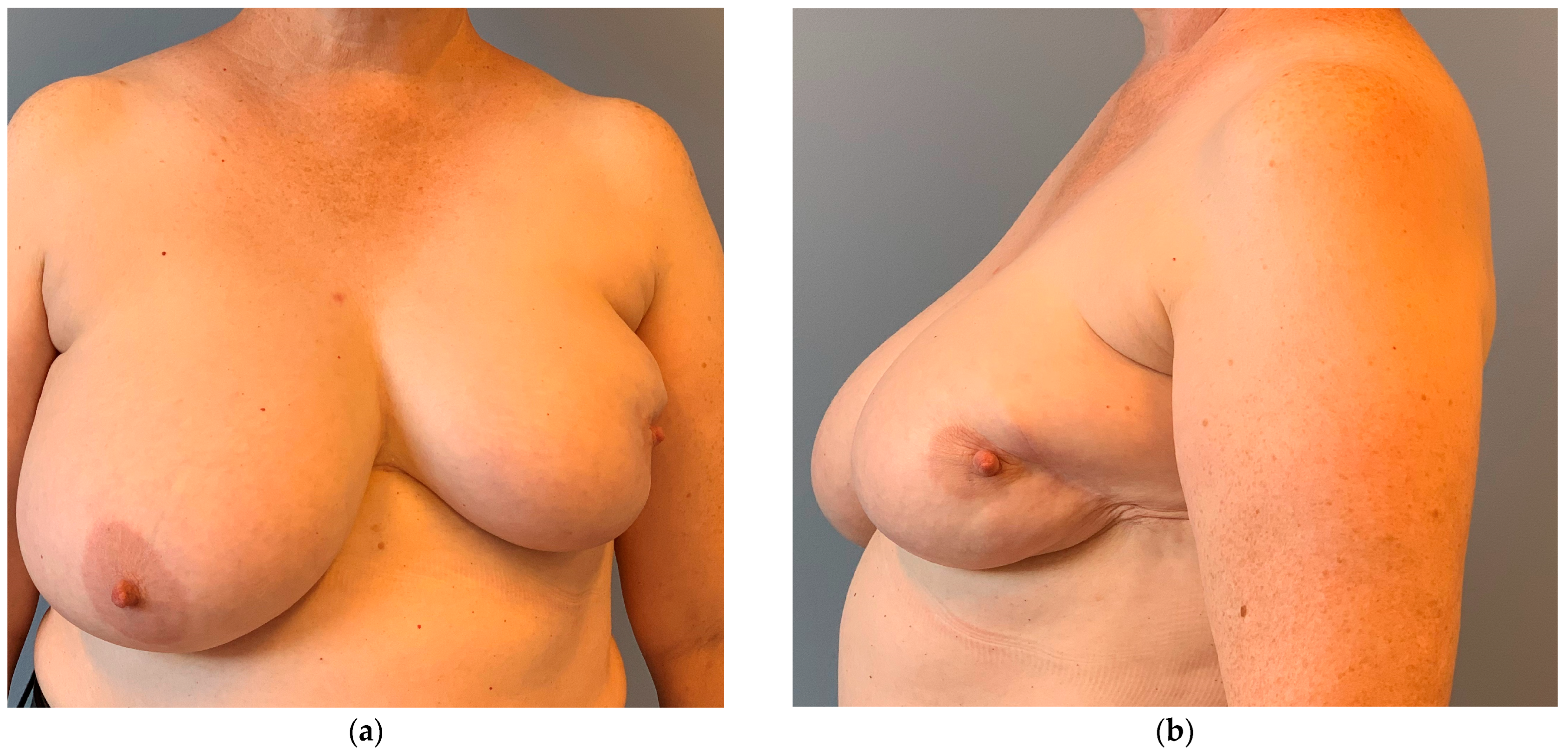 Cancers 16 03101 g001