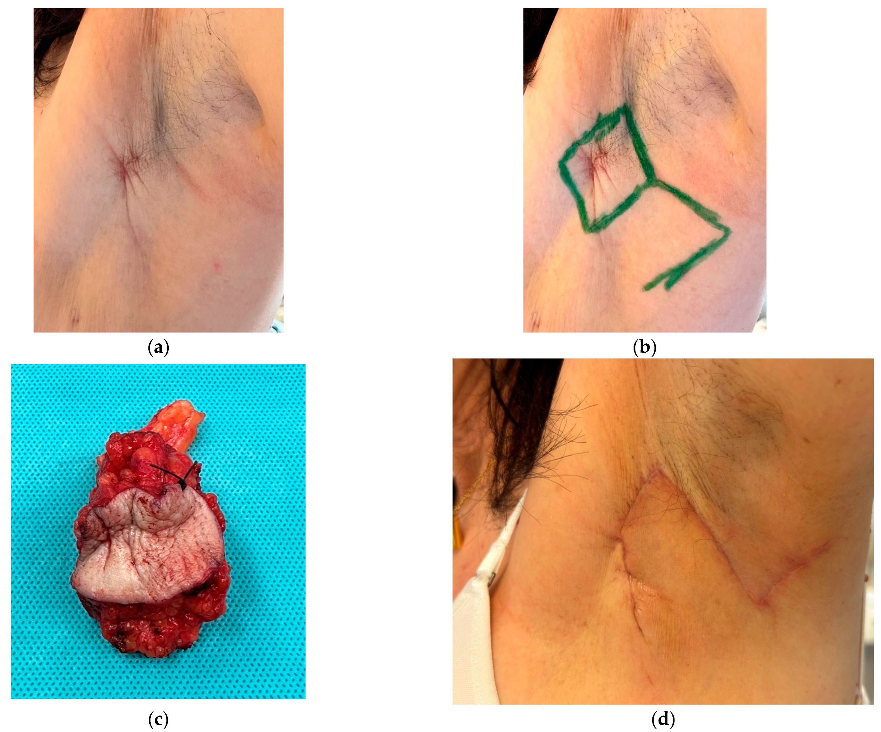 Cancers 16 03101 g005