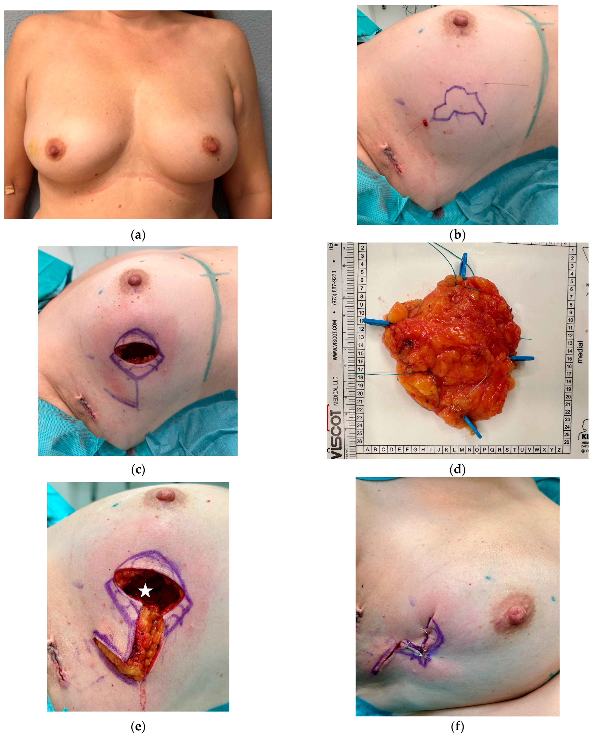 Cancers 16 03101 g006a