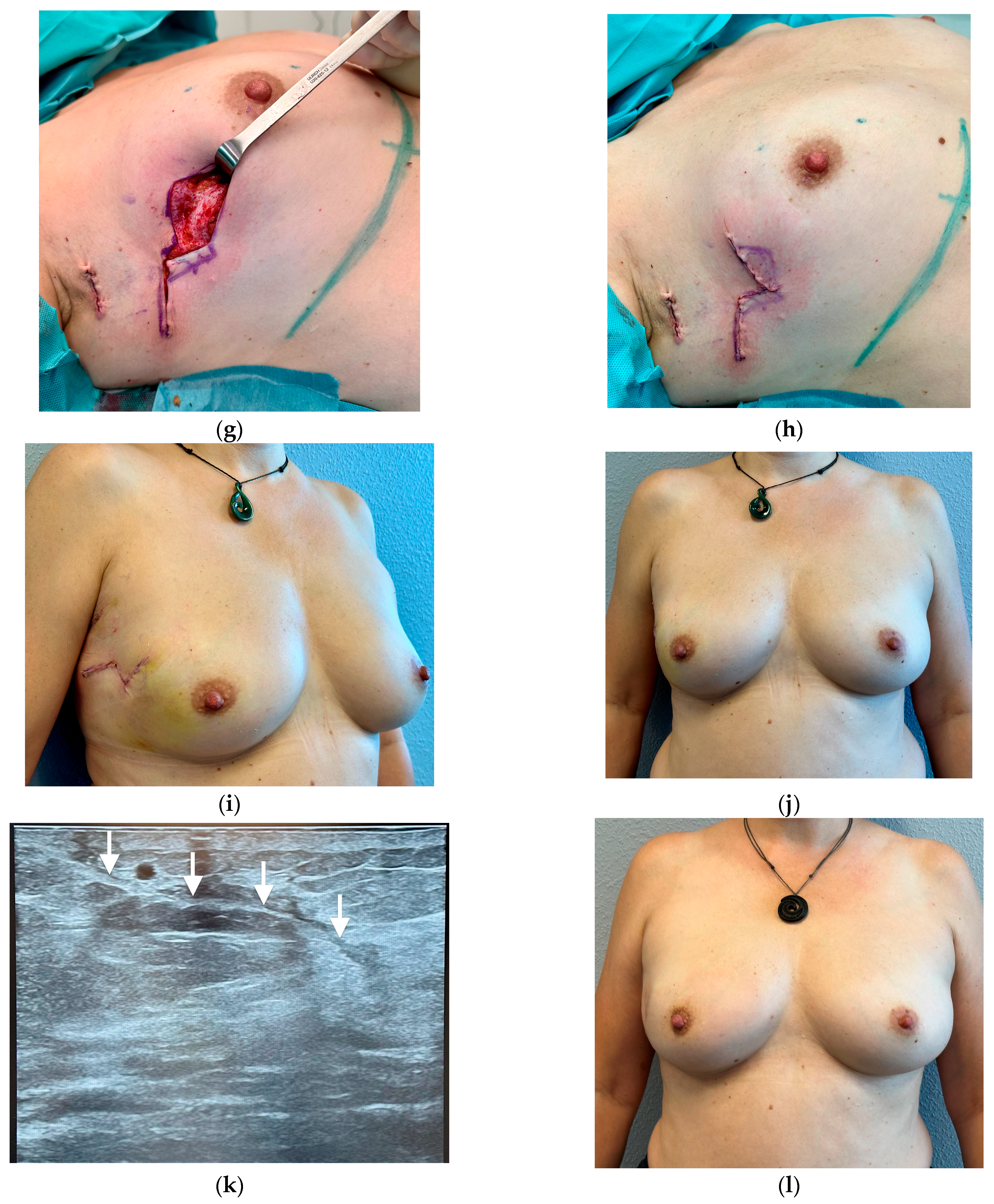 Cancers 16 03101 g006b