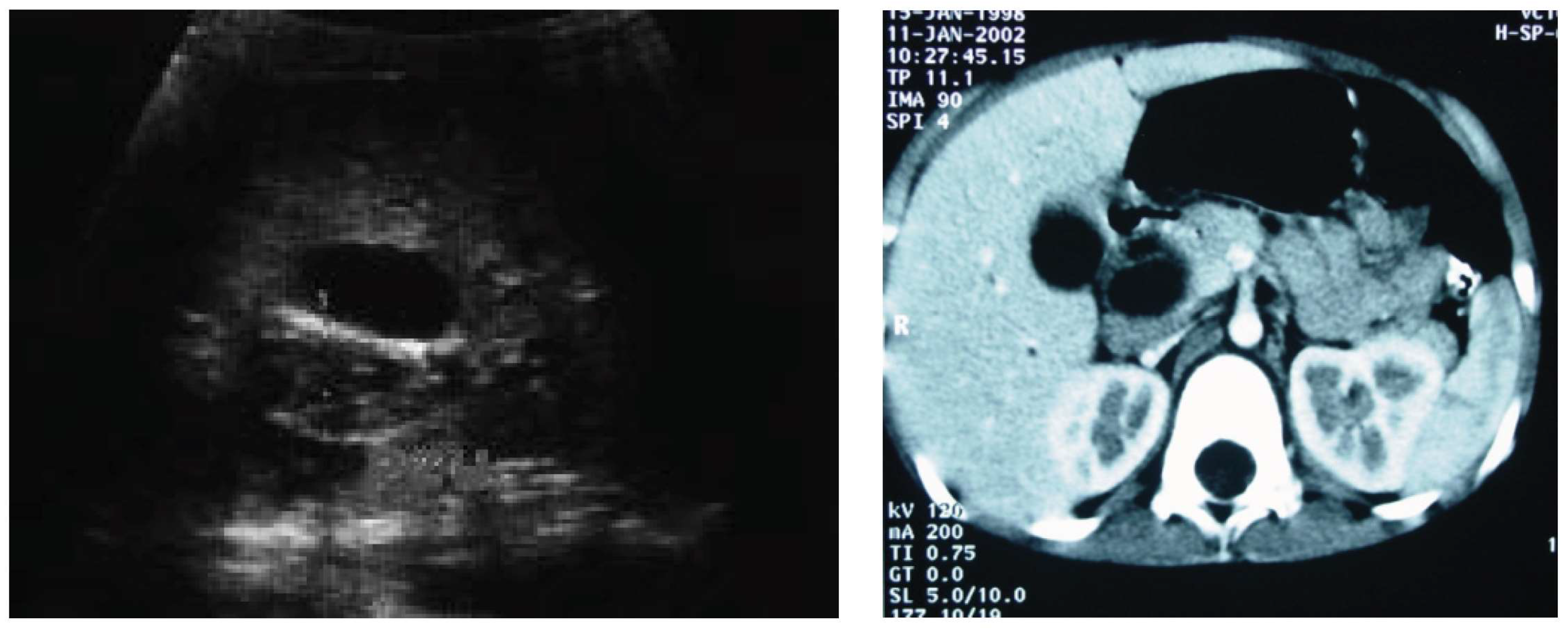 Cancers 16 03110 g001