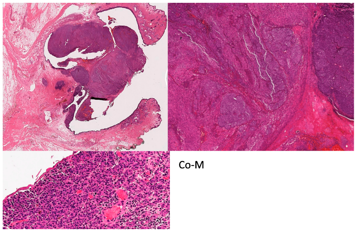 Cancers 16 03121 g002