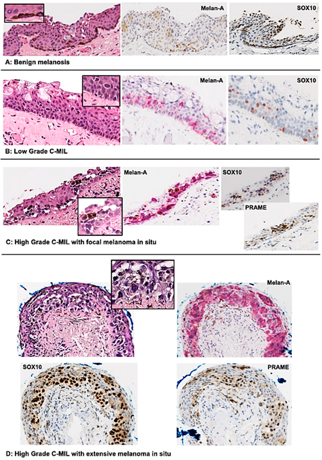 Cancers 16 03121 g003