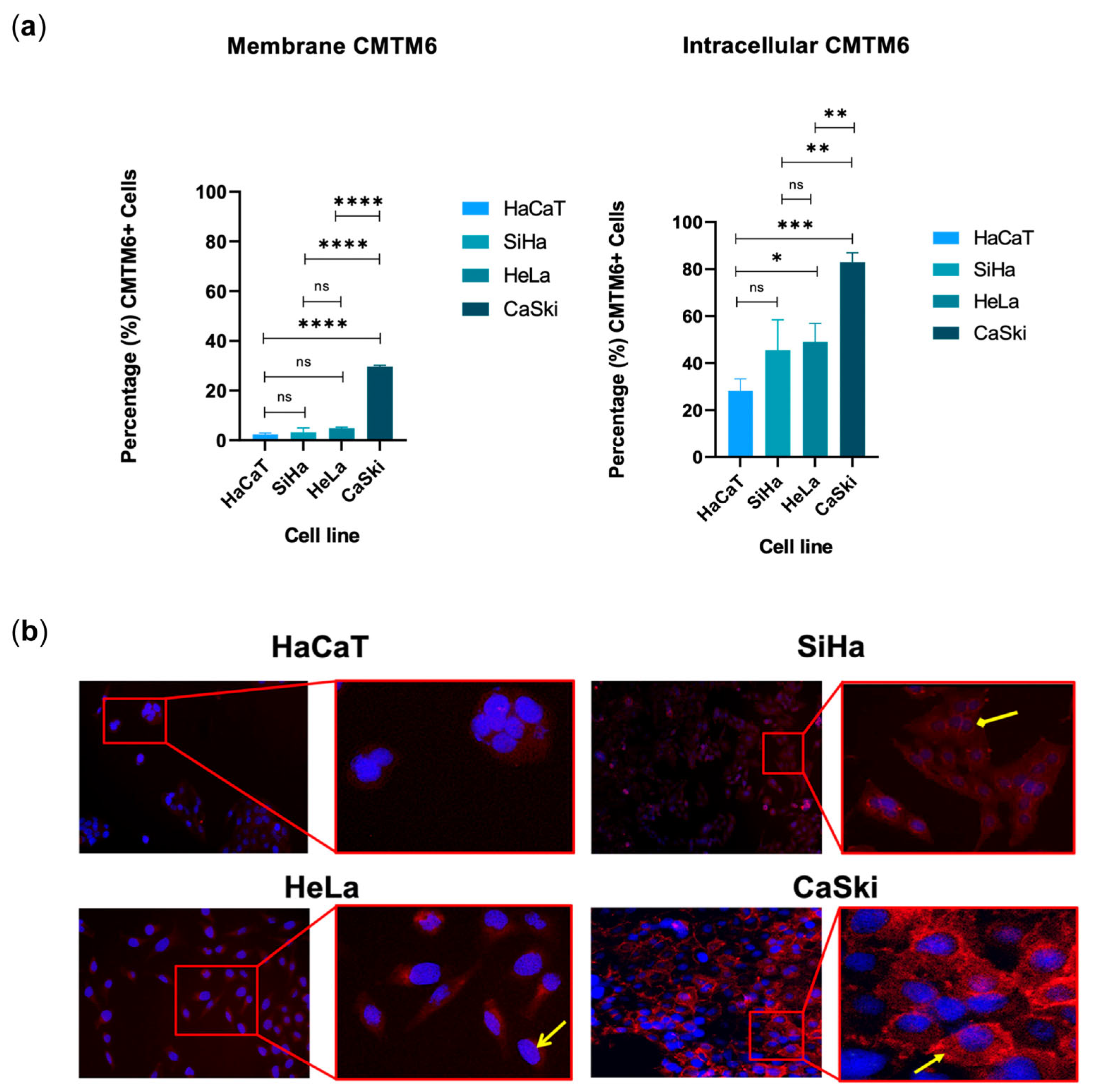 Cancers 16 03126 g004