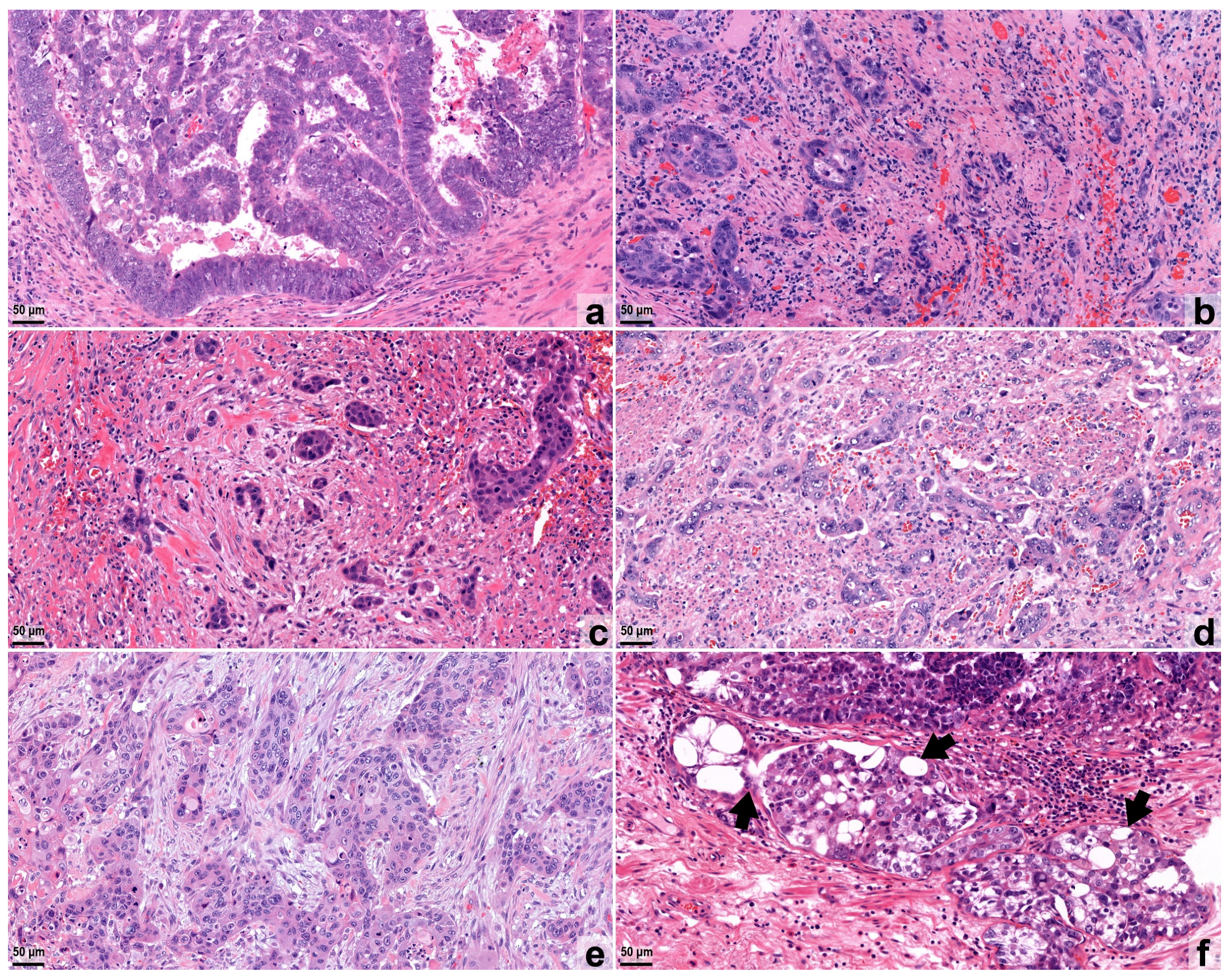 Cancers 16 03144 g001