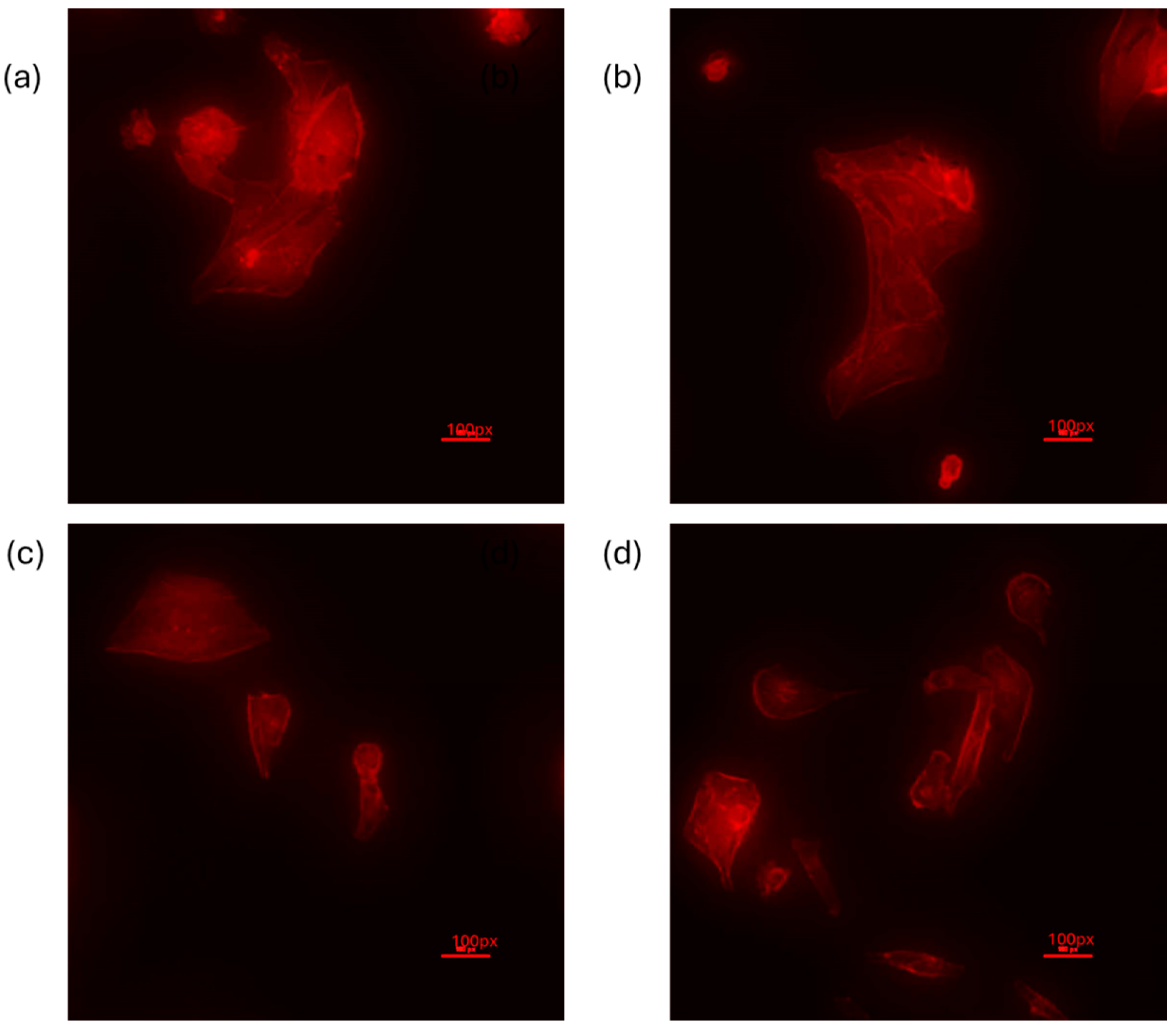Cancers 16 03166 g011