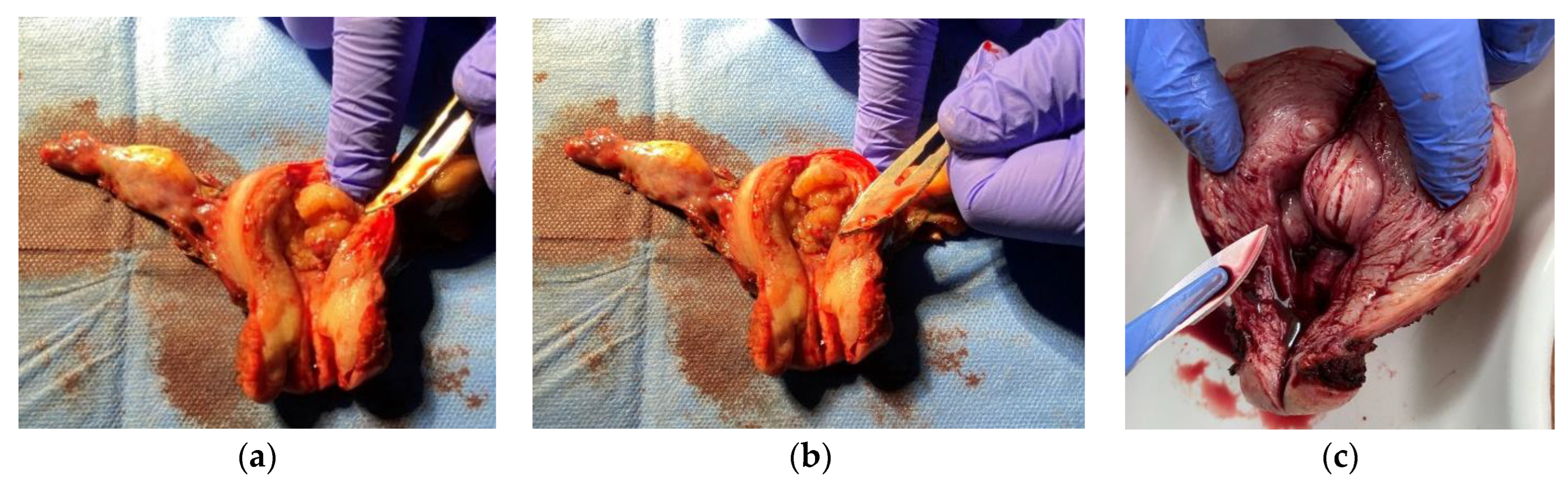 Cancers 16 03169 g001