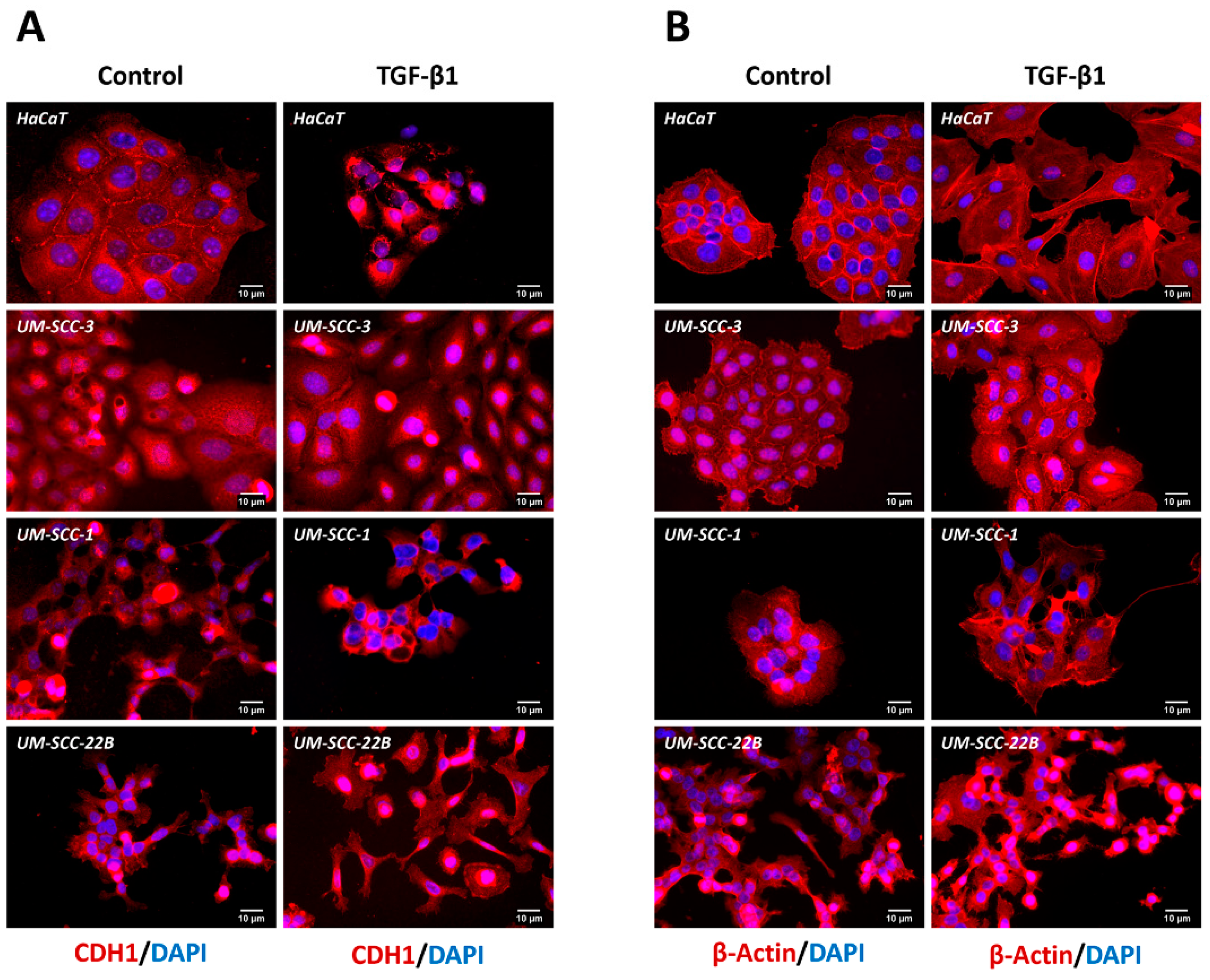 Cancers 16 03172 g004