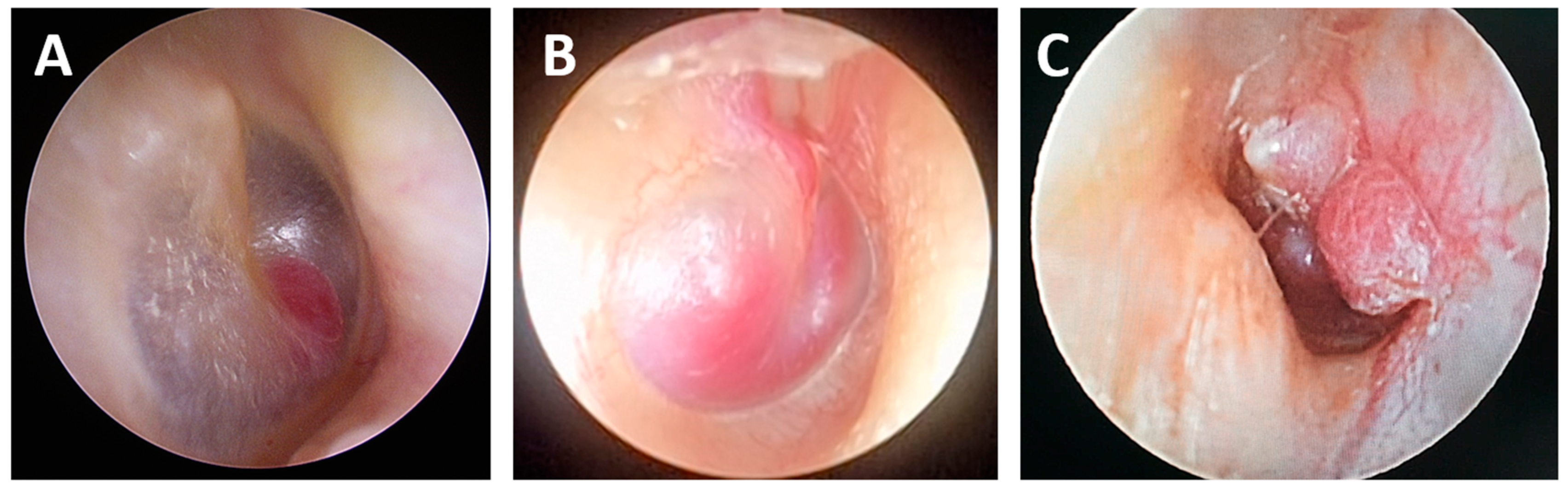 Cancers 16 03178 g001
