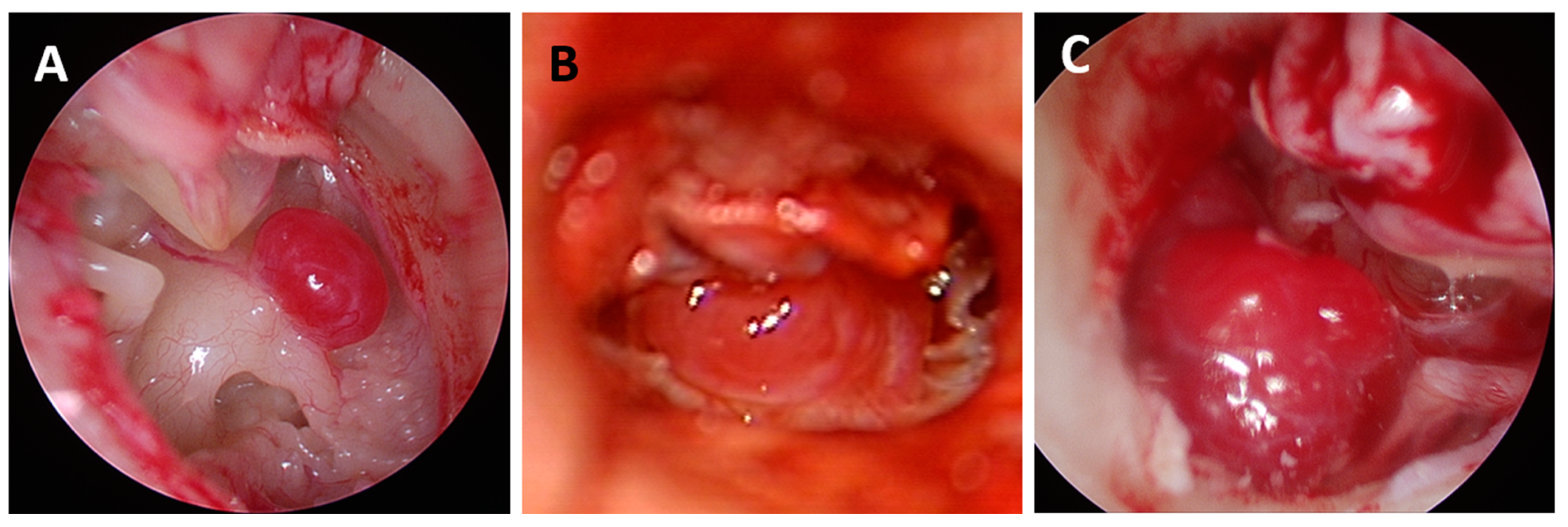 Cancers 16 03178 g004