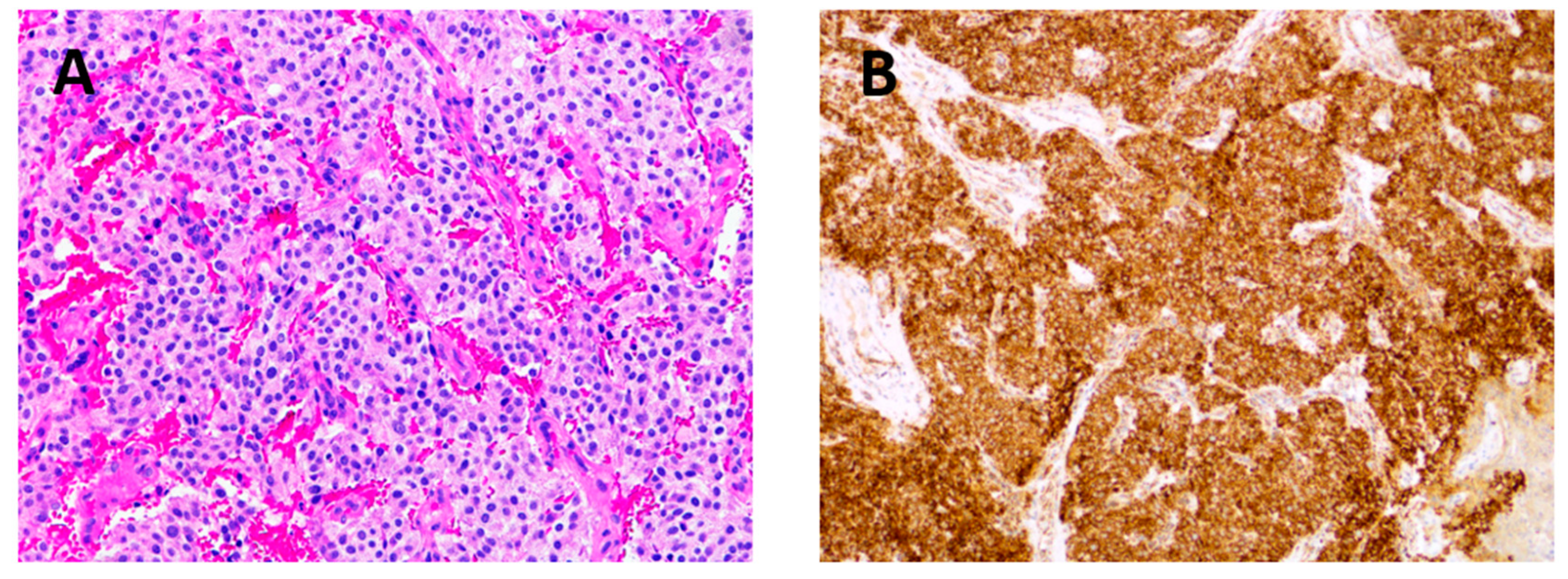 Cancers 16 03178 g005