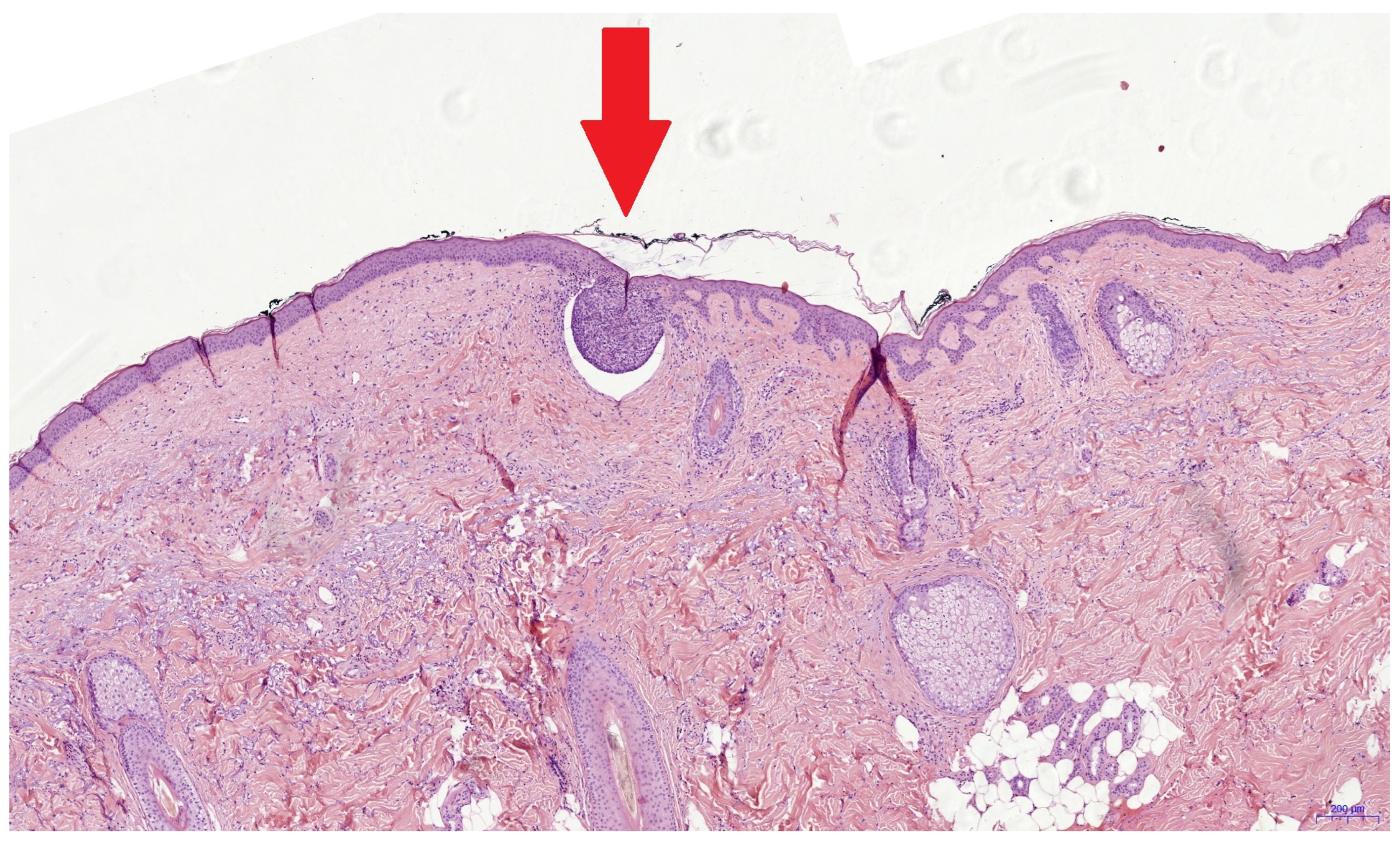 Cancers 16 03209 g002